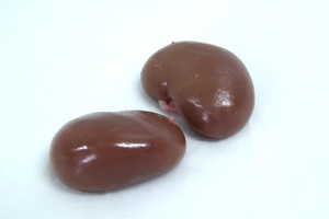 Kidneys